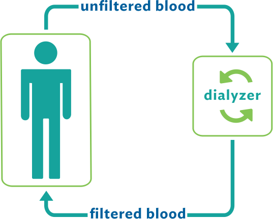 In-center hemodialysis process: unfiltered blood from your body enters a dialyzer, then becomes filtered blood that goes back into your body.